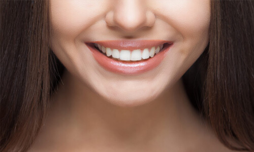 Close-up picture of a smiling young woman with long brown hair, showing perfect white teeth and happiness with her Holistic sinus lift treatment she received at Premier Holistic Dental in beautiful Costa Rica.