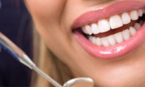 Close-up picture of a smiling young woman, with perfect white teeth, and happy with her Holistic dental Cavitation treatment at Premier Holistic Dental in beautiful Costa Rica.  The picture shows a dental tool near her mouth illustrating how the Cavitation treatment is performed.