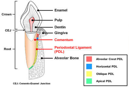 Illustration of a dental removal periodontal ligament procedure, showing how it is  done in Costa Rica.