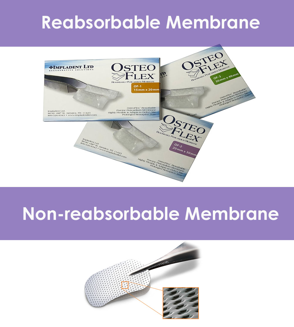 A picture of 3 packages of reabsorbable membranes and non-reabsorbable membranes use by the world famous Premier Holistic Dental in San Jose, Costa Rica.  The picture shows the packages laid on a table, with the front of the packages facing upwards and readable.