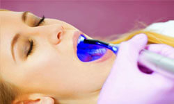 Close-up picture of a woman patient showing an ozone therapy dental procedure at Premier Holistic Dental in beautiful Costa Rica.  The picture shows a blue ozone light emanating from a dental tool.