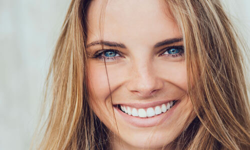 Close-up picture of a smiling young woman with long sandy brown hair, happy with her Platelet Rich Plasma (PRP) treatment at Premier Holistic Dental in beautiful Costa Rica.
