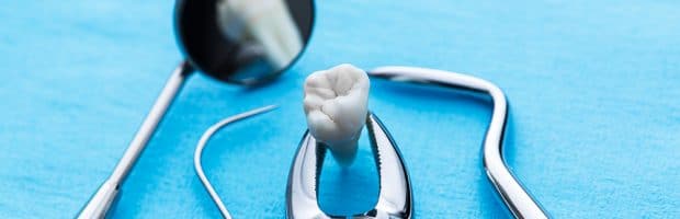 Picture of a dental tray with dental tools at the world famous Premier Holistic Dental in San Jose, Costa Rica.  The tools are silver, and the tray background is a bright blue.